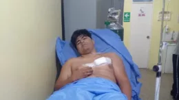 Confrontación en Ciudad de Dios: Un Presunto Ladrón Herido tras Enfrentamiento con la Policía