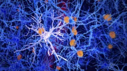 Descubren células cerebrales que podrían detener Alzheimer
